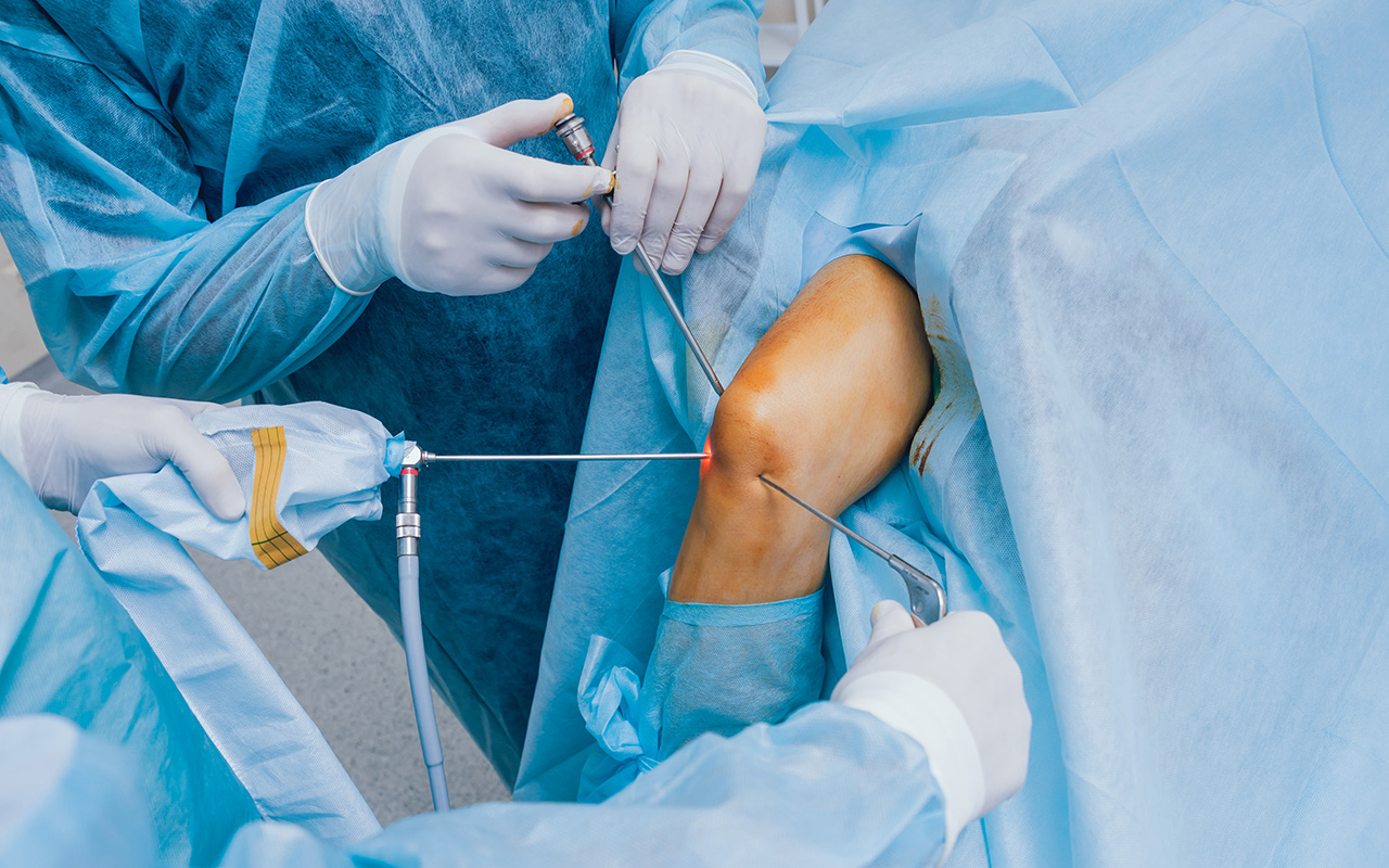 Arthroscopy Knee Surgery