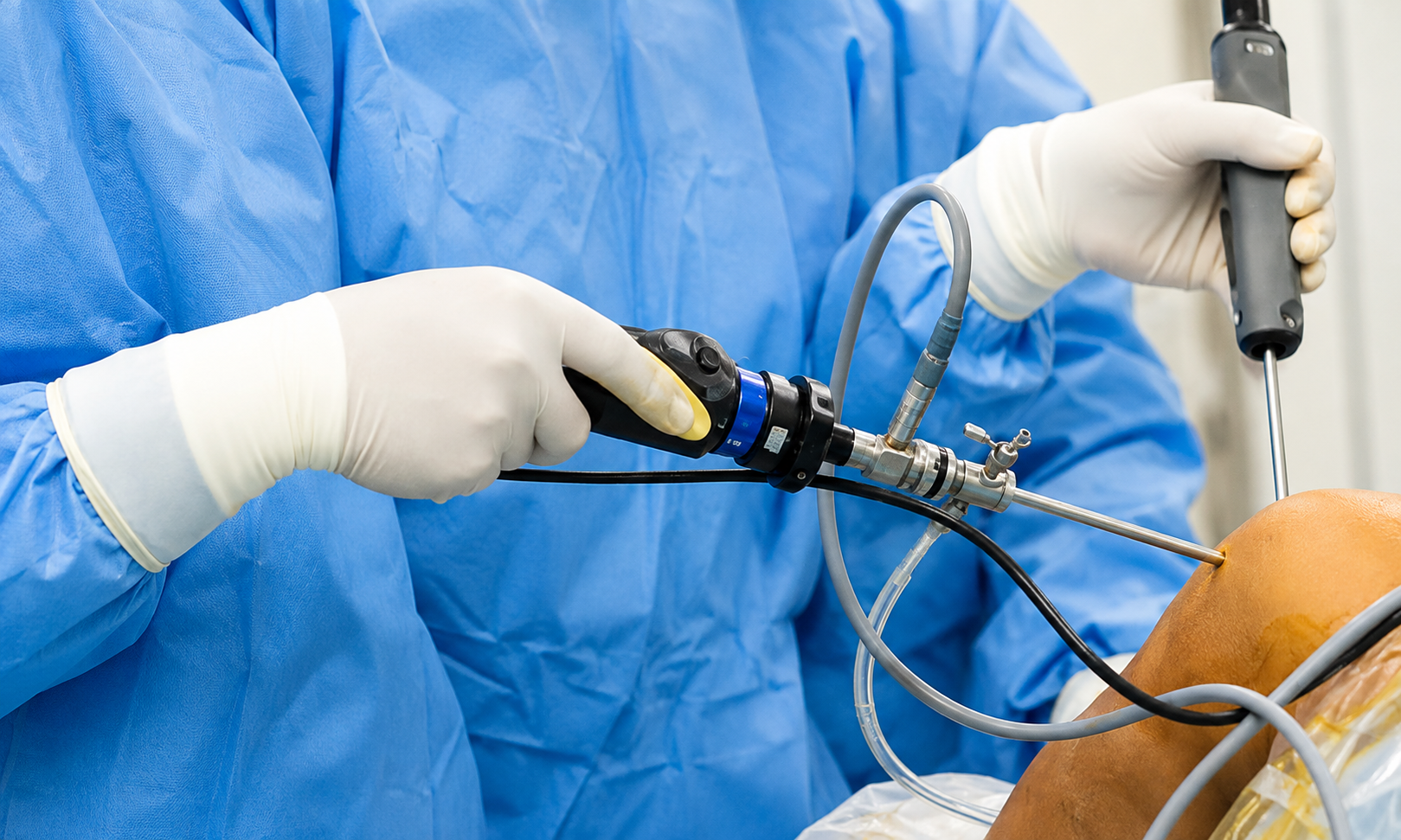 Arthroscopy Shoulder Surgery