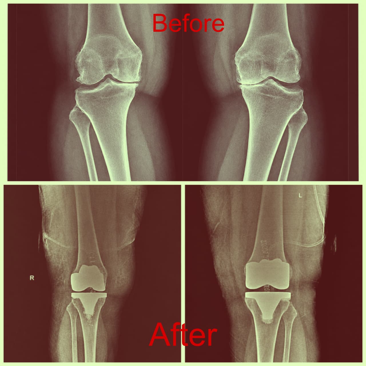 Ortho Clinic in Adyar