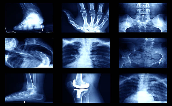 Digital X-Ray